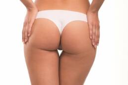 unison model from behind for unison cellulite treatment