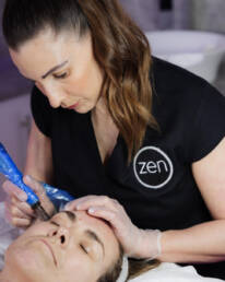 rejuvapen micro-needling zen